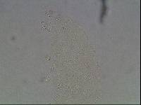 Hypsibius calcaratus image