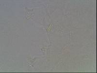Hypsibius calcaratus image