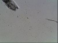 Hypsibius calcaratus image