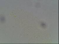 Hypsibius calcaratus image