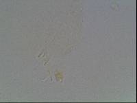 Hypsibius calcaratus image
