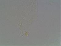Hypsibius calcaratus image