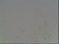 Hypsibius calcaratus image