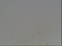 Hypsibius calcaratus image