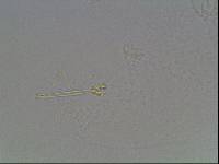 Hypsibius calcaratus image