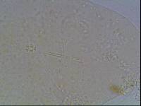 Hypsibius calcaratus image