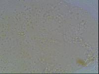 Hypsibius calcaratus image