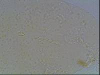 Hypsibius calcaratus image