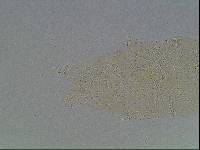 Hypsibius calcaratus image