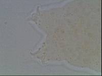 Hypsibius calcaratus image
