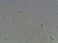Hypsibius calcaratus image