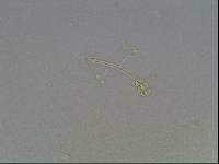 Hypsibius calcaratus image