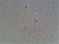 Hypsibius calcaratus image