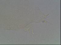 Hypsibius calcaratus image