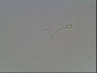 Hypsibius calcaratus image