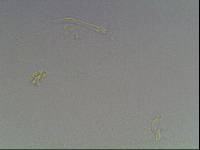 Hypsibius calcaratus image