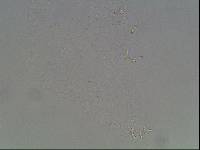 Hypsibius calcaratus image