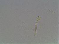Hypsibius calcaratus image