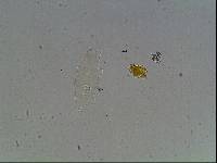 Hypsibius calcaratus image