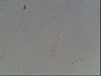 Hypsibius calcaratus image