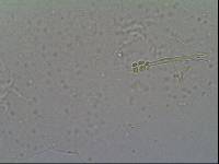 Hypsibius calcaratus image