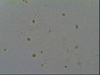 Hypsibius calcaratus image