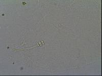 Hypsibius calcaratus image