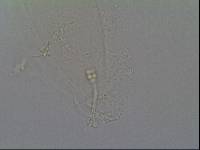 Hypsibius calcaratus image