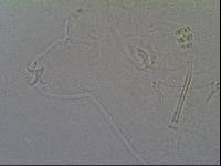 Hypsibius calcaratus image