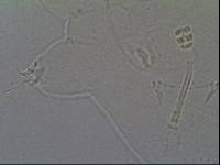 Hypsibius calcaratus image