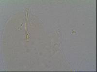 Hypsibius calcaratus image