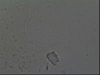 Hypsibius calcaratus image
