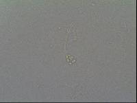 Hypsibius convergens image