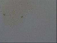 Hypsibius convergens image