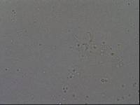Hypsibius convergens image
