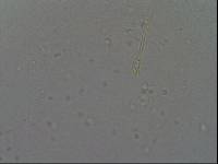 Hypsibius convergens image