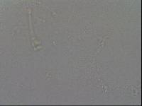 Hypsibius convergens image