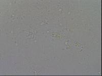 Hypsibius convergens image