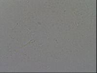 Hypsibius convergens image