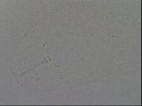 Hypsibius convergens image