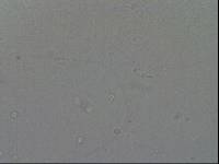 Hypsibius convergens image