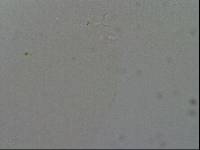 Hypsibius convergens image