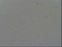 Hypsibius convergens image