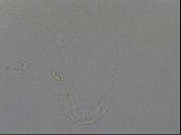 Hypsibius convergens image