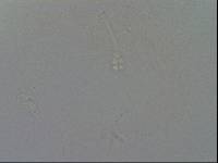 Hypsibius convergens image