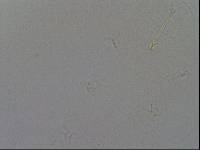 Hypsibius convergens image