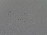 Hypsibius convergens image