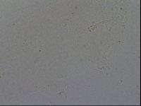 Hypsibius convergens image