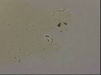 Echiniscoides sigismundi image